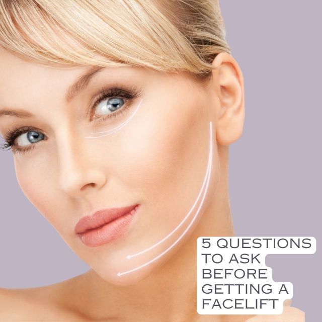 Thinking about a facelift? 🤔 Here are the top 5 questions to ask your surgeon before making a decision. Stay informed and confident! 💉✨ #facelifttips #plasticsurgeryadvice #stayinformed #beautyadvice